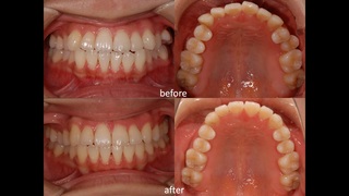 before,after.jpg